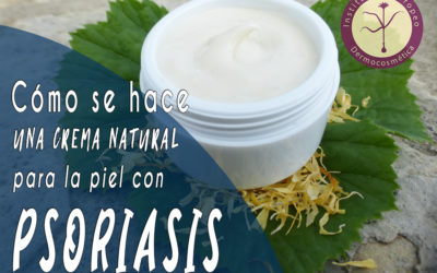 Cómo se hace una Crema Natural para la Piel con Psoriasis